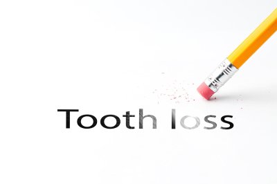 tooth loss