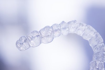 invisalign - aligners